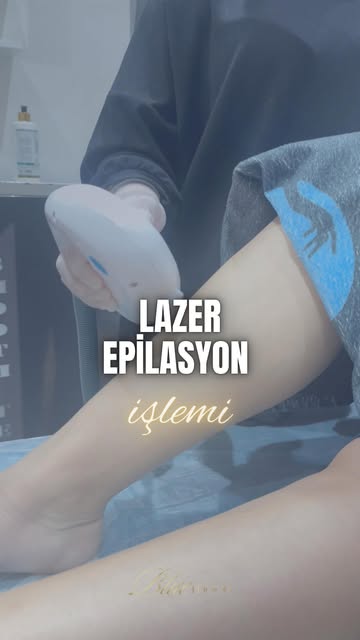 Afyonkarahisar'da Lazer Epilasyon ile Pürüzsüz Cilde Kavuşmak Artık Daha Kolay